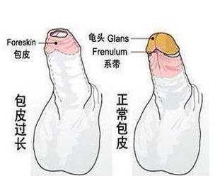 阴蒂包皮手术视频